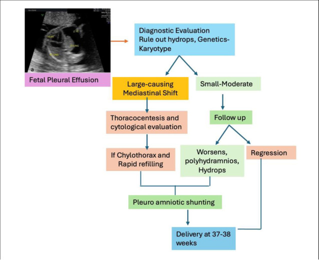 Tiny Lungs, Big Challenges: Navigating Fetal Pleural Effusion Outcomes, Long Term Follow-up and Implications for Future Pregnancies.