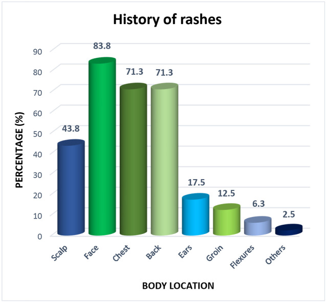 Clinical Profile of Seborrhoeic Dermatitis Patients Seen in a Tertiary Hospital in Lagos, Nigeria - A Case-Control Study.