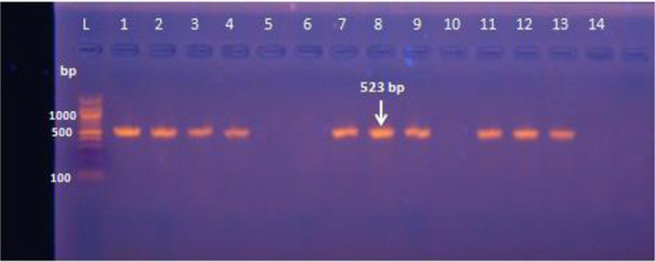 Immunological and molecular detection of biofilm formation and antibiotic resistance genes of <i>Pseudomonas aeruginosa</i> isolated from urinary tract.