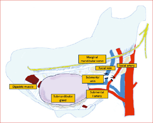 Exploring the use of submental flap for parotid region reconstruction: a multicentric experience.