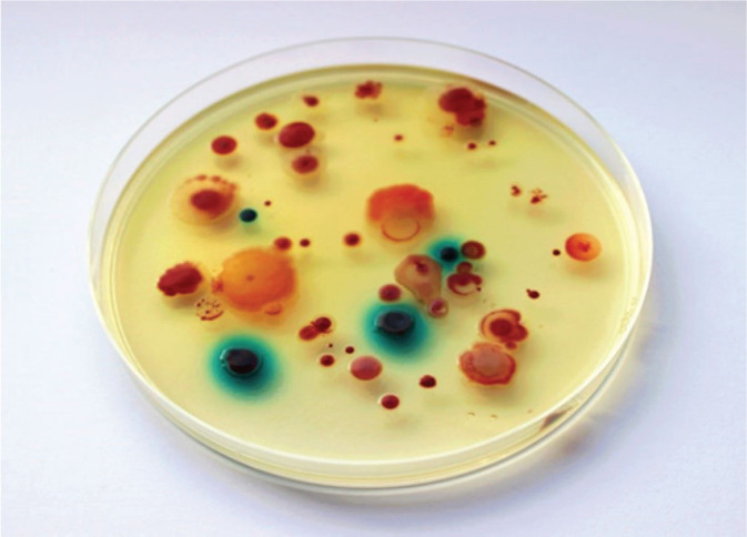 Carbapenem-resistant bacteria in the environment.