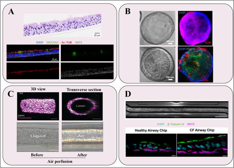 Airway Organoid Models as Pivotal Tools for Unraveling Molecular Mechanisms and Therapeutic Targets in Respiratory Diseases: A Literature Review.