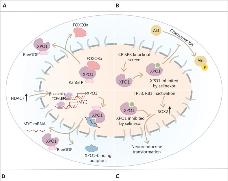 XPO1 as a key regulator in small cell lung cancer: mechanisms, biomarkers, and therapeutic implications.
