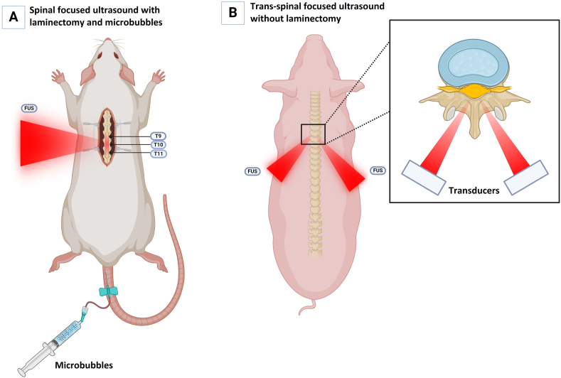 Potential applications of focused ultrasound for spinal cord diseases: a narrative review of preclinical studies.