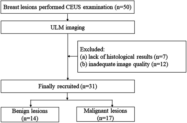 Differentiation of benign and malignant breast lesions by ultrasound localization microscopy.