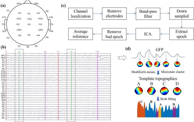 Classification of left and right-hand motor imagery in acute stroke patients using EEG microstate.