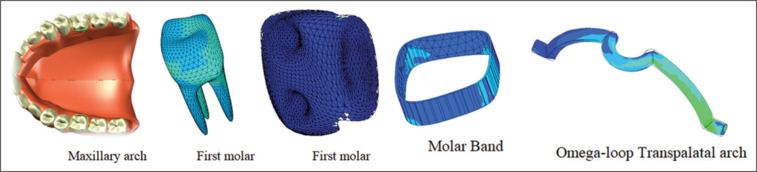 Finite element analysis of the transpalatal arch force systems activated in the Burstone geometries with different materials.
