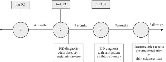 Recurrent Pelvic Inflammatory Disease After Serial Intrauterine Inseminations.