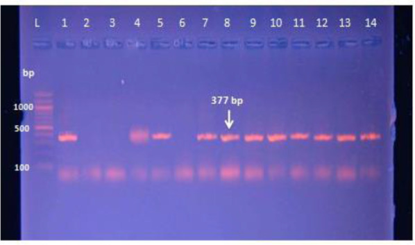 Immunological and molecular detection of biofilm formation and antibiotic resistance genes of <i>Pseudomonas aeruginosa</i> isolated from urinary tract.