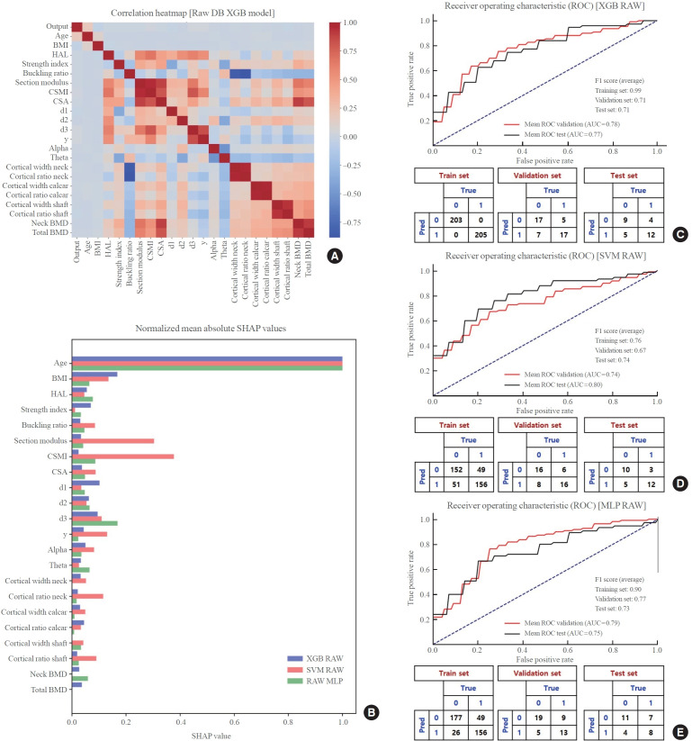 Synthetic Data-Enhanced Classification of Prevalent Osteoporotic Fractures Using Dual-Energy X-Ray Absorptiometry-Based Geometric and Material Parameters.