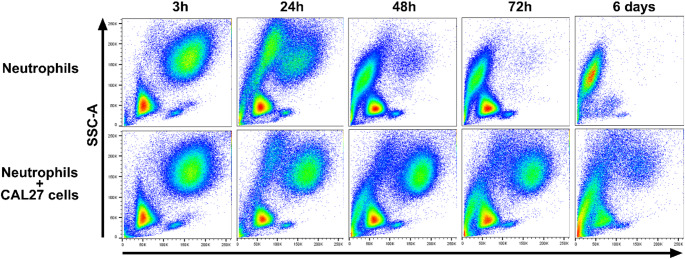 CD18 and CD36 expression in neutrophils from tumors and tumor-draining lymph nodes: implications for metastasis in oral squamous cell carcinoma.