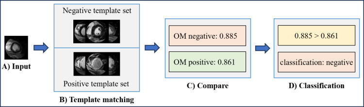 Investigating methods to enhance interpretability and performance in cardiac MRI for myocardial scarring diagnosis using convolutional neural network classification and One Match.