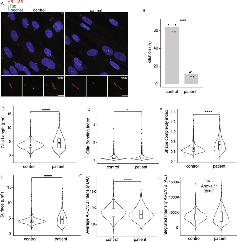 Defective IFT57 underlies a novel cause of Bardet-Biedl syndrome.