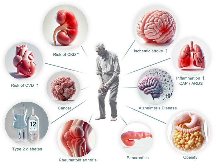 Adipose Factor ANGPTL4: Its Role in Aging Mechanisms and Associated Diseases.