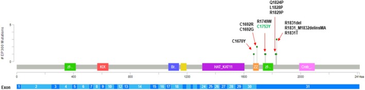 A Novel EP300 Variant in an African American Girl With Global Developmental Delay and Leukemia.