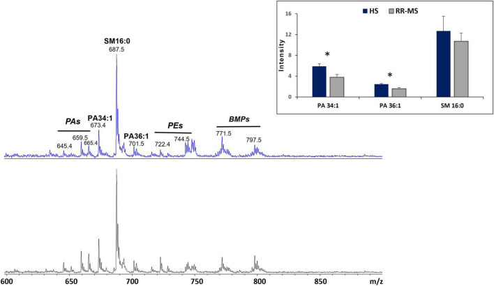 Circulating exosomes with unique lipid signature in relapsing remitting multiple sclerosis.
