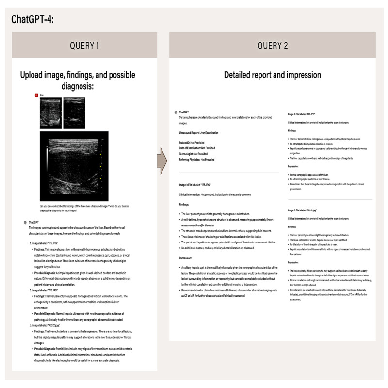 ChatGPT-4-Driven Liver Ultrasound Radiomics Analysis: Diagnostic Value and Drawbacks in a Comparative Study.