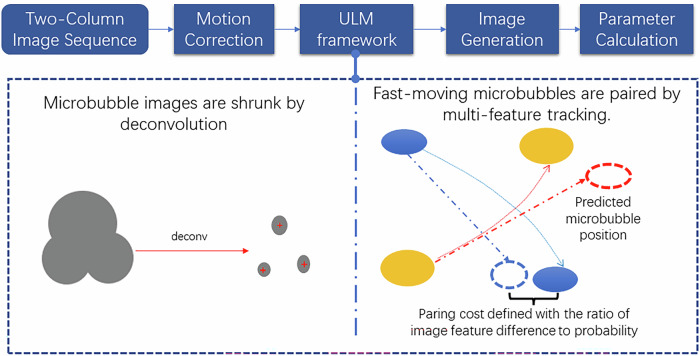 Differentiation of benign and malignant breast lesions by ultrasound localization microscopy.