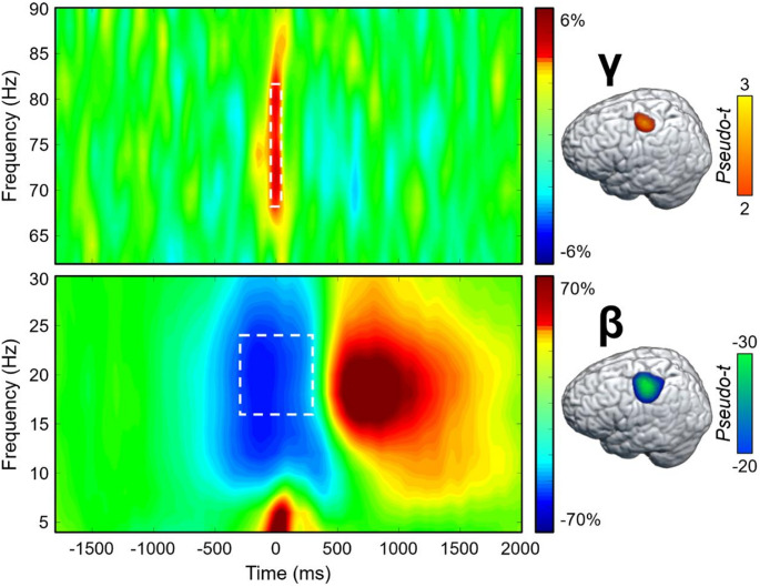 Motor-Related Neural Dynamics are Modulated by Regular Cannabis Use Among People with HIV.