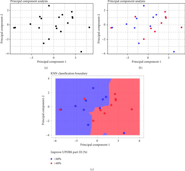 Predictive Value of Brain Volumetry in the Response to Subthalamotomy Using High-Intensity Focused Ultrasound Treatment in Patients With Parkinson's Disease.