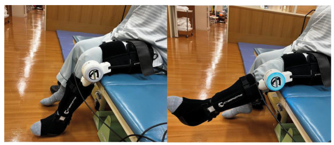 Effects of Supplemental Robot-Assisted Knee Flexion Exercise After Total Knee Arthroplasty: A Randomized Controlled Clinical Study.