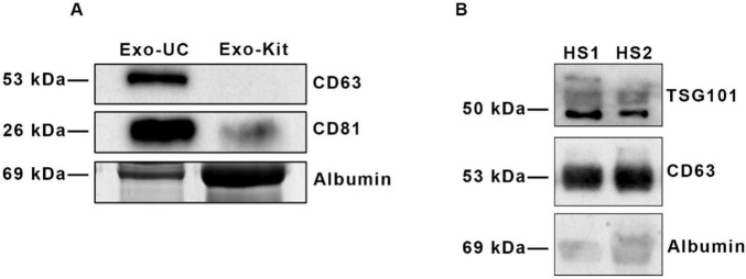 Circulating exosomes with unique lipid signature in relapsing remitting multiple sclerosis.