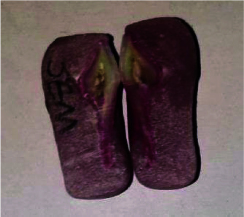 Efficacy of Remineralizing Agents for Prevention of Microhardness Reduction and Change in Mineral Content of Enamel in Anterior Primary Teeth after Exposure to Iron Drop.