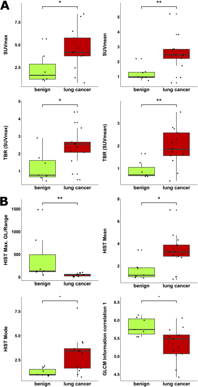 Image analysis: <sup>68</sup>Ga-FAPI-46 PET derived texture parameters improve the differentiation of malignant and benign pulmonary lesions.