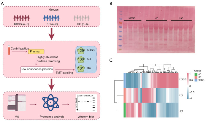 Up-regulated vitronectin in Kawasaki disease shock syndrome serves as a potential biomarker.