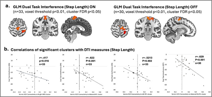 Reduced automaticity in freezing of gait is associated with elevated cortico-cerebellar connectivity.