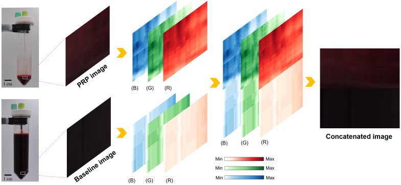 Efficient quality control of platelet-rich plasma preparation using computer vision and deep learning.