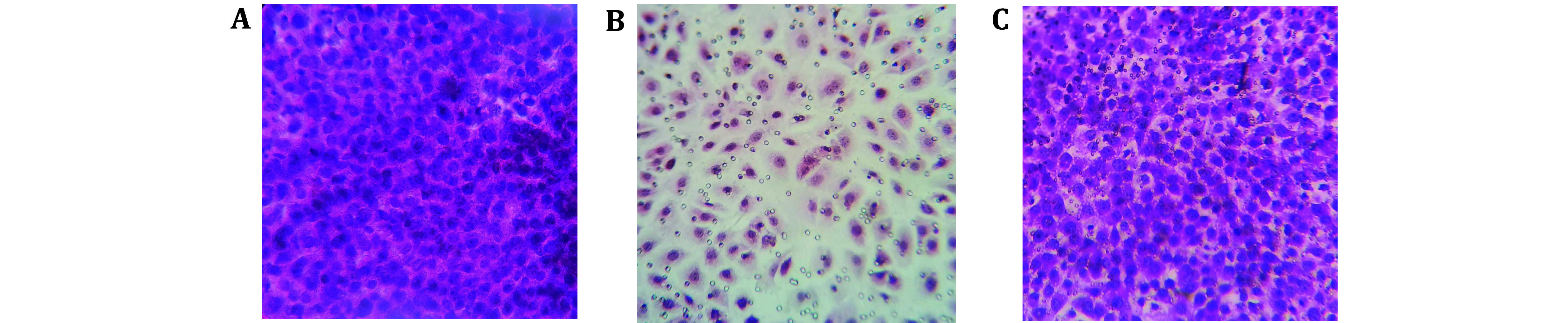 Assaying antigen-specific T cell trans-endothelial migration <i>in vitro</i> with the Transwell system: application in tumor immunology.