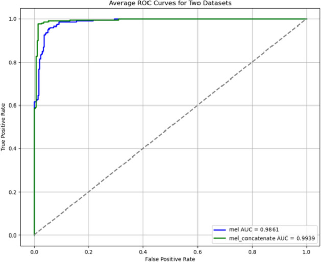 Research on automatic assessment of the severity of unilateral vocal cord paralysis based on Mel-spectrogram and convolutional neural networks.