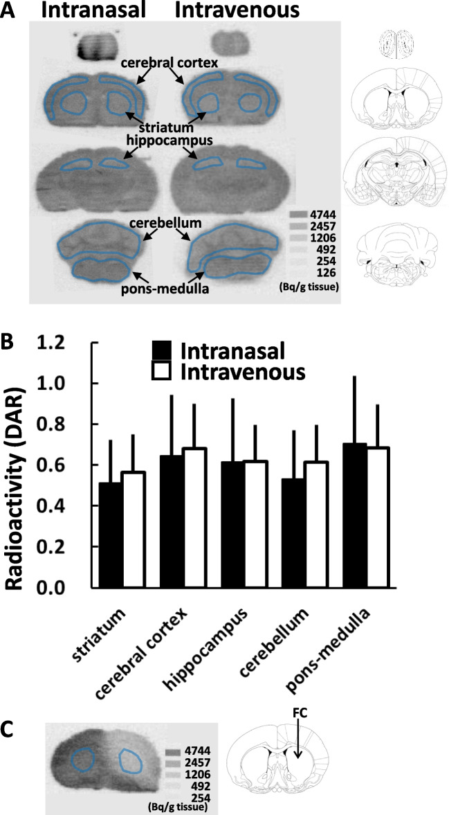 Ex-vivo Imaging of Glial Energy Metabolism in the Neonatal Mouse Brain during Convulsive Seizures with Intranasal Radiotracer Administration.