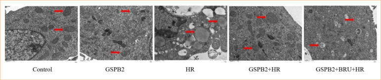 Impact of grape seed proanthocyanidin B2 pretreatment on mitochondrial oxidative stress, endoplasmic reticulum stress, and apoptosis in renal tubular epithelial cells during in-vitro hypoxia-reoxygenation.