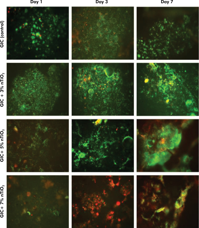 Effect of titanium dioxide nanotubes incorporated into conventional glass ionomer cement on L. acidophilus.