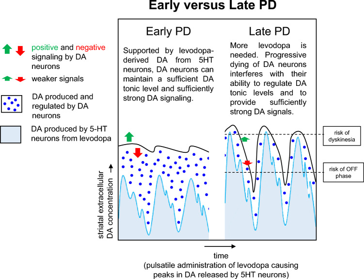 Levodopa treatment: impacts and mechanisms throughout Parkinson's disease progression.
