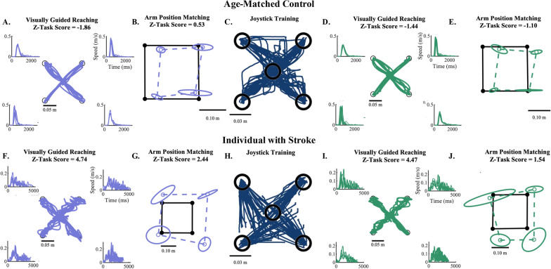 A pilot study for self-guided, active robotic training of proprioception of the upper limb in chronic stroke.