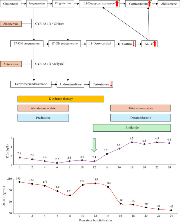 Severe Late-Onset Abiraterone-Induced Hypokalemia in a Diabetic Patient With Concomitant Adrenal Gland Incidentaloma: A Diagnostic Challenge.