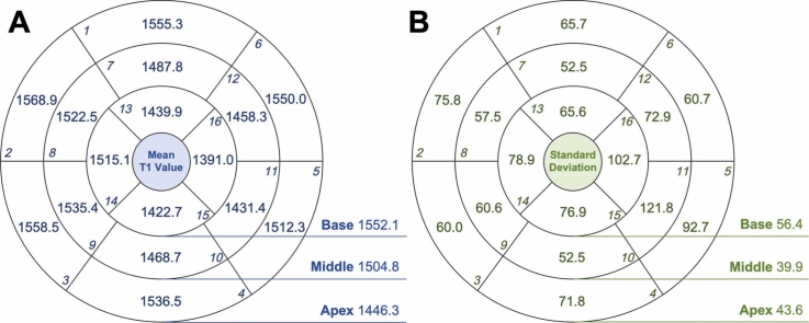Myocardial native T1 and extracellular volume measurements at 5T: Feasibility study and initial experience.
