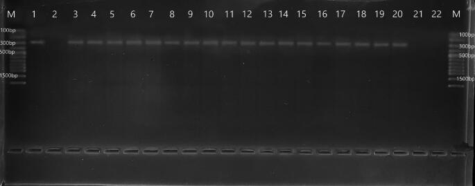 The First Molecular Detection of the Presence and Prevalence of Trypanosoma theileri in Cattle from Türkiye