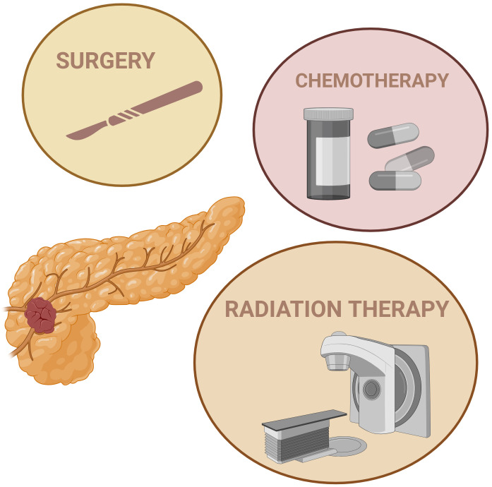 An overview of the feasibility of nanomedicine in pancreatic cancer theranostics.