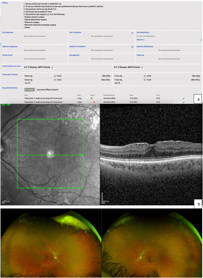 Virtual vitreoretinal clinics: a service delivery pathway of the future.