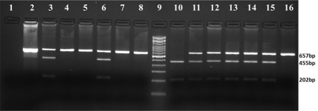 Impact of Xmn1 polymorphism on hydroxyurea therapy in children with HbE-β non-transfusion dependent thalassemia: a cohort study.