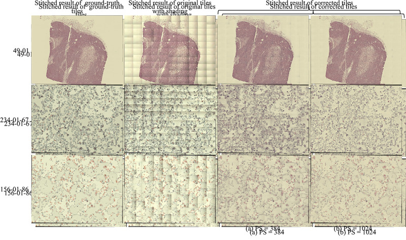 Training Set Design for Uneven Illumination Correction in High-Resolution Whole Slide Images.