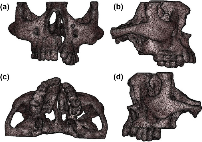 Evaluation of Stress in the Maxillary Complex of a Unilateral Cleft Lip and Palate on Simulated Occlusal Loading Using Finite Element Analysis.