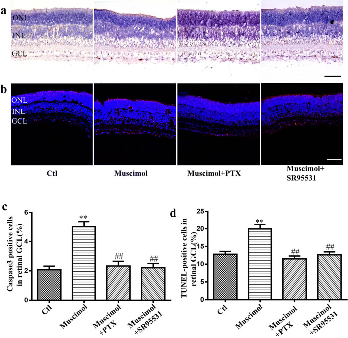 Dopamine attenuates ethanol-induced neuronal apoptosis by stimulating electrical activity in the developing rat retina.