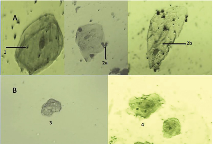 Clumpy Novel Mitochondrial Signatures in Irradiated Human Diabetic Buccal Cells: A Case Control Study.