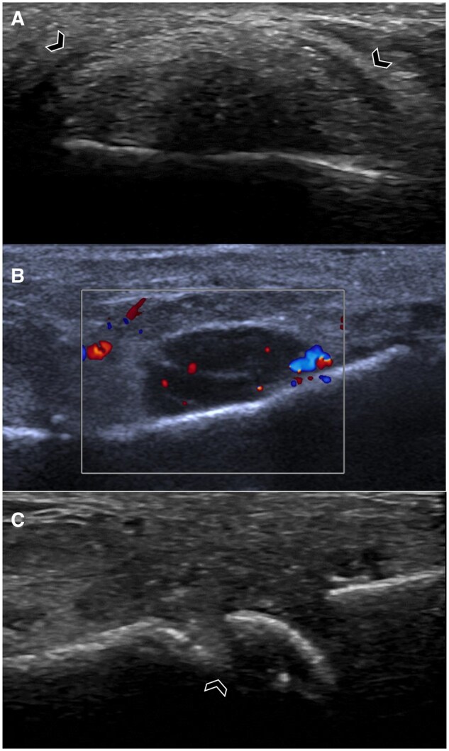 Imaging of gout: an atlas.
