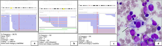 Clinicopathological and Immunogenetic Characterization in 8 Patients with Familial Hemophagocytic Lymphohistiocytosis Type 2: A Study from North India with Literature Review.